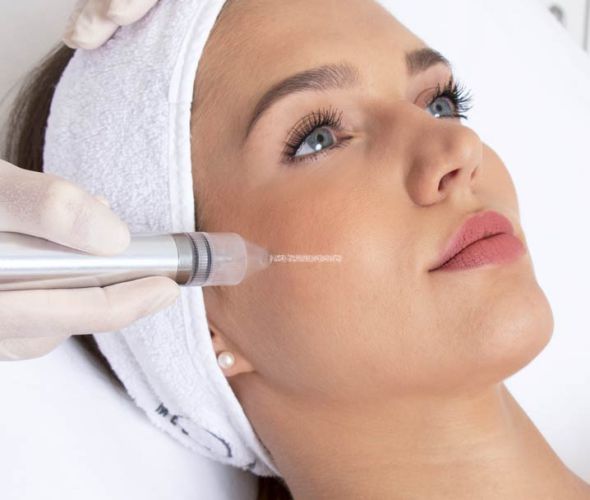 Mikrodermabrazja i złuszczanie skóry Wrocław | DEVORA